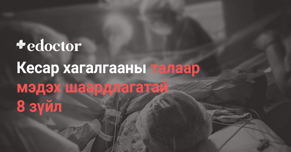 Кесар хагалгааны талаар мэдэх шаардлагатай 8 зүйл - Цахим эмч